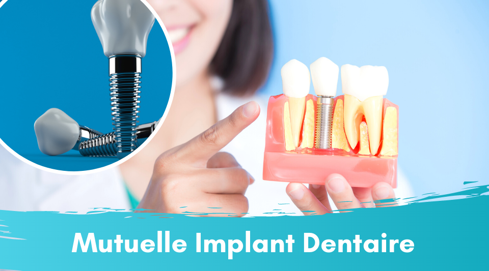 implant dentaire remboursé par la mutuelle mais pas par la sécu